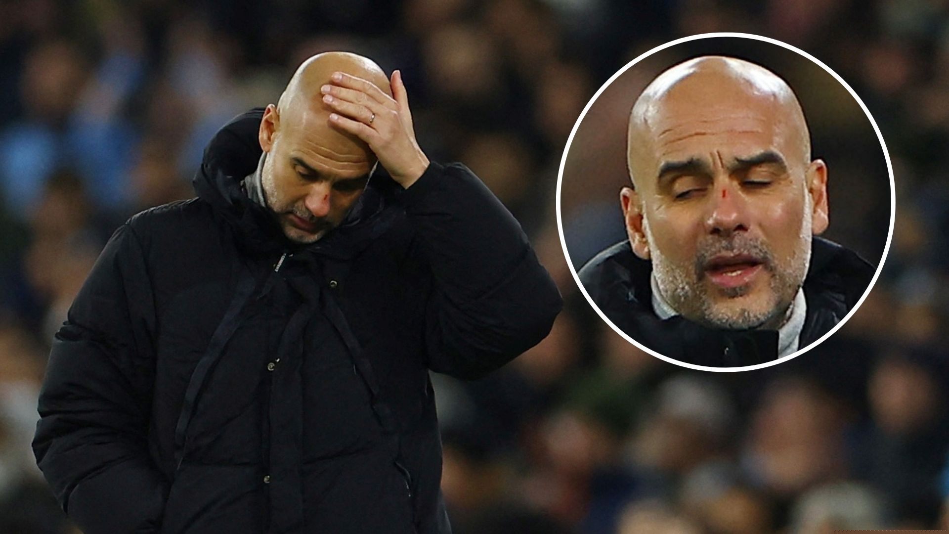 Guardiola's unsavoury explanation for face full of cuts