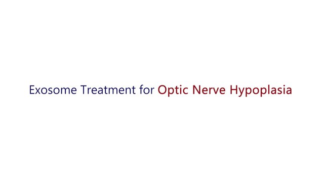 Exosome Treatment For Optic Nerve Hypoplasia | Best Stem Cell Center For Eye Disease |