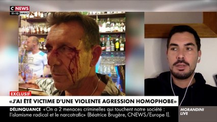EXCLU - En larmes, Rémi, victime d'une agression homophobe, craque dans "Morandini Live": "Je n'ose plus sortir de chez moi. Ils ont été remis en liberté et j'ai peur de les croiser" - Regardez