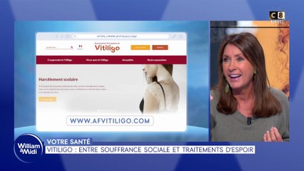 Votre santé : Vitiligo, entre souffrance sociale et traitements d'espoir