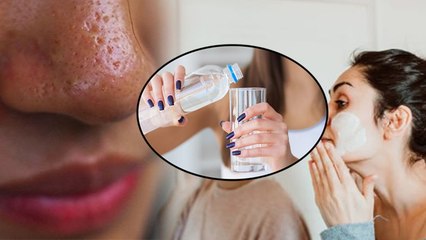 Oily Skin Causes In Winter: Shardiyo Me Oily Skin Hone Ke Kaaran, Reason & Treatment | Boldsky