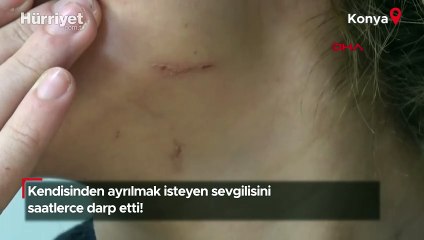 Kendisinden ayrılmak isteyen sevgilisini darp etti!