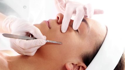 Che cos’è il dermaplaning?