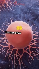 Alternative Breast Cancer Treatments in Mexico with Apatone IV and Curcumin