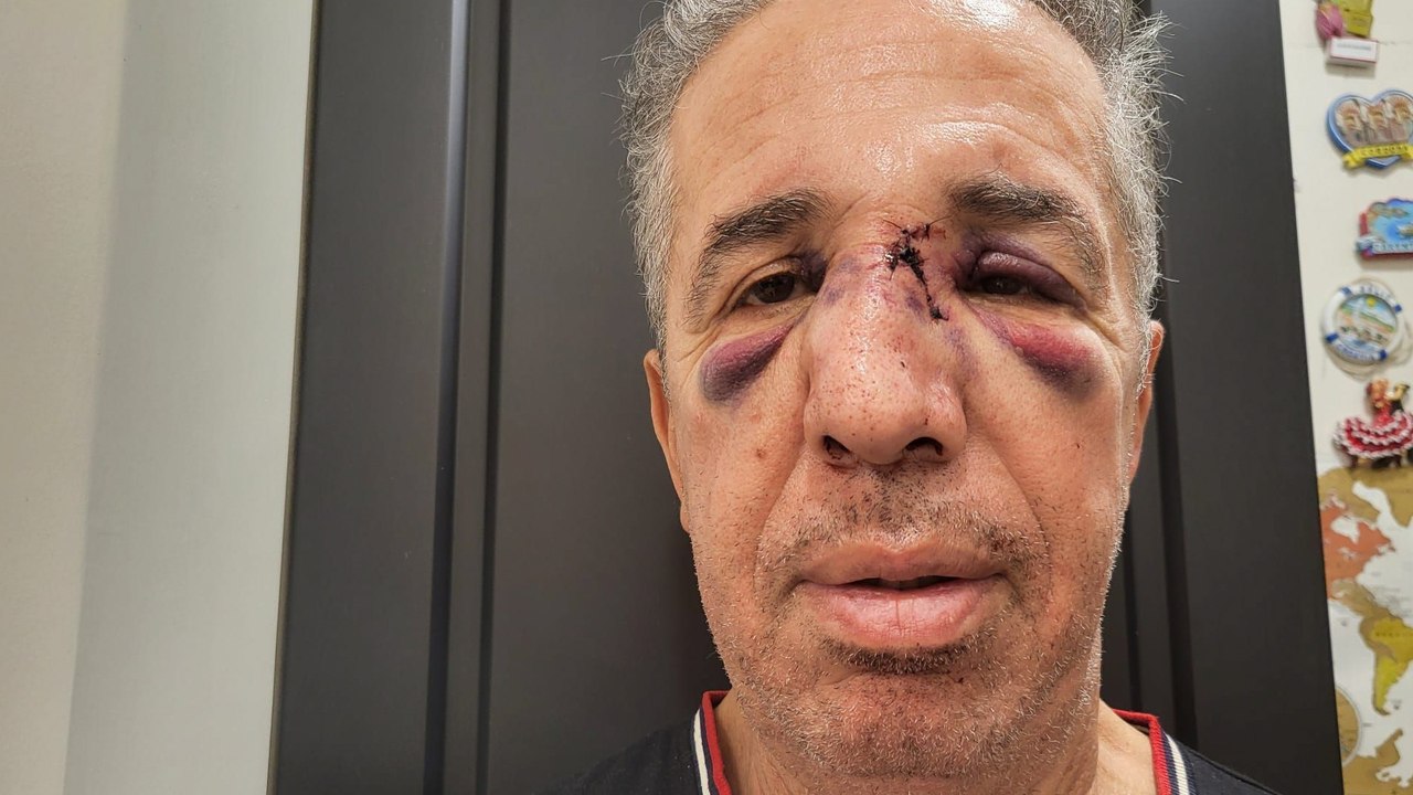 « La prochaine fois, ce sera quoi ? » : agressé dans son cabinet, ce médecin songe à arrêter