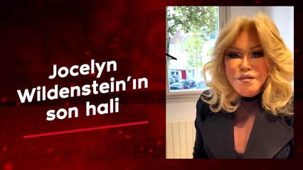 Kedi Kadın Jocelyn Wildenstein'ın son hali görenleri şaşırttı