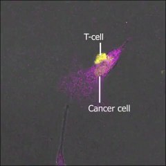 T-Lymphocytes Body Natural Defense against Cancer