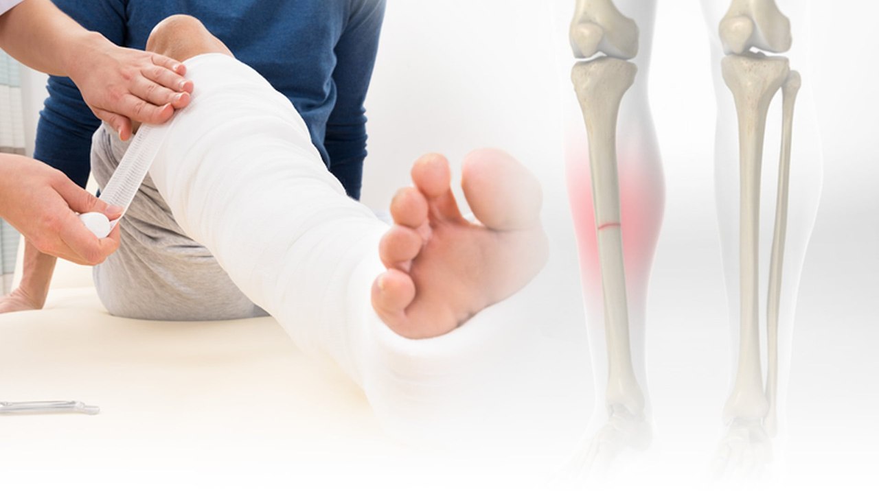 Xương gãy mau liền: Thực đơn "chuẩn khoa học" giúp rút ngắn thời gian phục hồi!