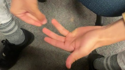 Magician's creepy trick as he seemingly breaks off fingers and swaps them around