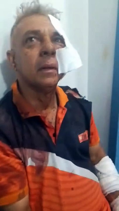 Motorista de carro fica ferido em grave acidente entre carro e caminhão em Rio Largo