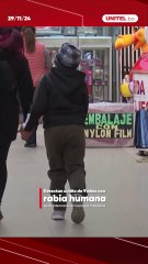 Un niño de 9 años dio positivo a rabia humana y está en terapia intensiva.