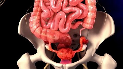 Endometriosis drug Visanne to be listed on the PBS, more than halving its annual cost