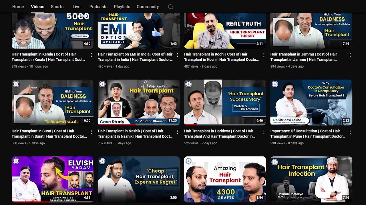 Hair Transplant in Surat | Best Hair Transplant Price and Amazing Hair Transplant Results in Surat