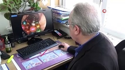 Küçük kızın bağırsağından çıkanlar şaşkınlık yarattı