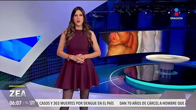 Tratamiento para la calvicie podría provocar el síndrome de hombre lobo en bebés
