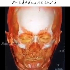 Every soul shall taste death