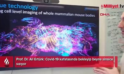 Covid-19 kafatasında bekleyip beyne sinsice sızıyor