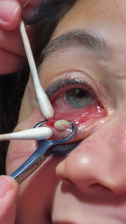 Versuche nicht WEGZUGUCKEN bei diesem VIDEO!