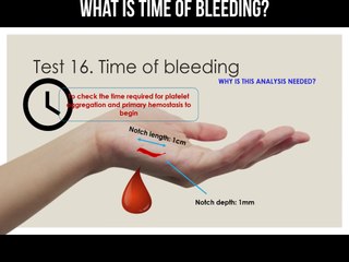 What is time of bleeding?