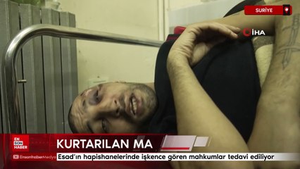 Esad'ın hapishanelerinde işkenceye maruz kalan mahkumlar tedavi ediliyor