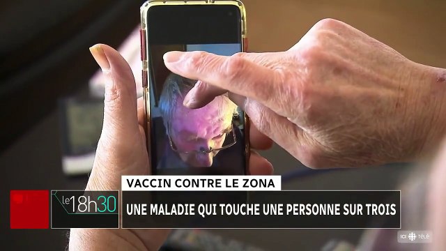 Le vaccin Shingrix contre le zona, produit par les laboratoires GSK, sera désormais pris en charge par l’Assurance Maladie en France pour les personnes de 65 ans et plus