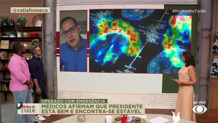 Neurologista explica hematoma subdural Lula: "Procedimento simples" | Melhor da Tarde