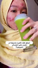 شاهد كيف تغير وجهها تمامًا بعد الديتوكس  نتائج مذهلة!