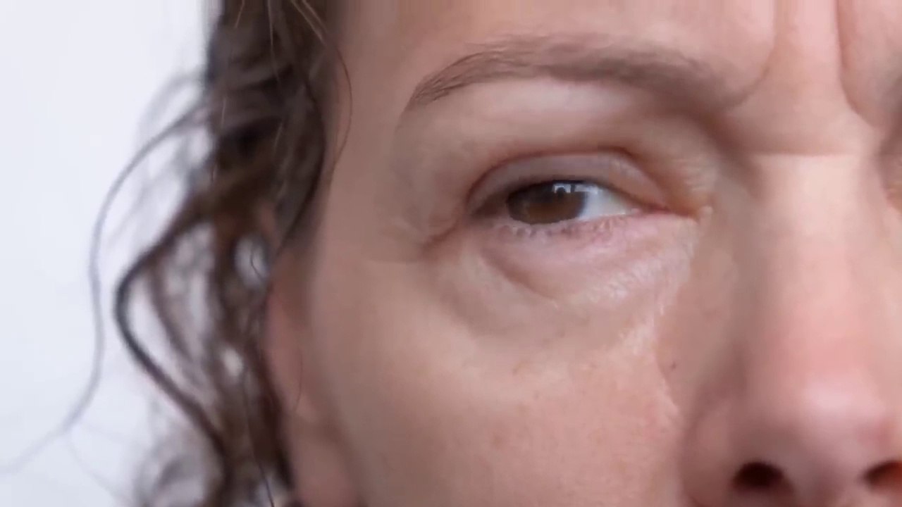 Best way to reduce puffy eyes