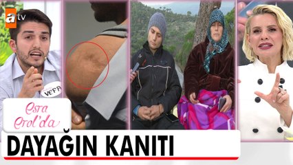 Bir anne evladına bunu nasıl yapar? - Esra Erol'da 12 Aralık 2024