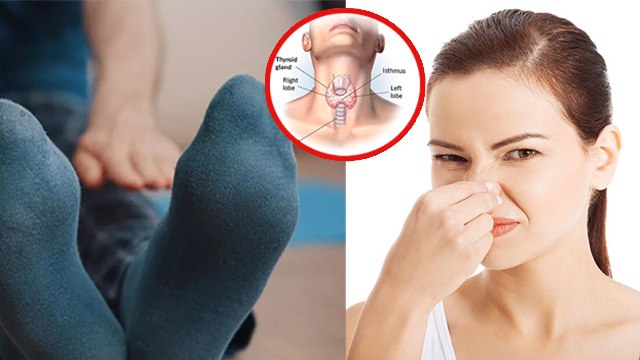 Foot Smell Causes: Pero Se Badbu Kyu Aati Hai | Diabetes, High BP & Thyroid Early Symptoms