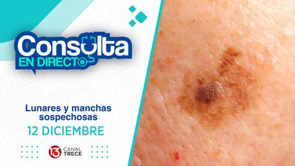 12 Diciembre 2024 | Consulta en Directo - Lunares y manchas sospechosas