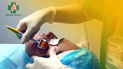 Cách chăm sóc da sau lăn kim chuẩn y khoa từ Bác sĩ Da liễu