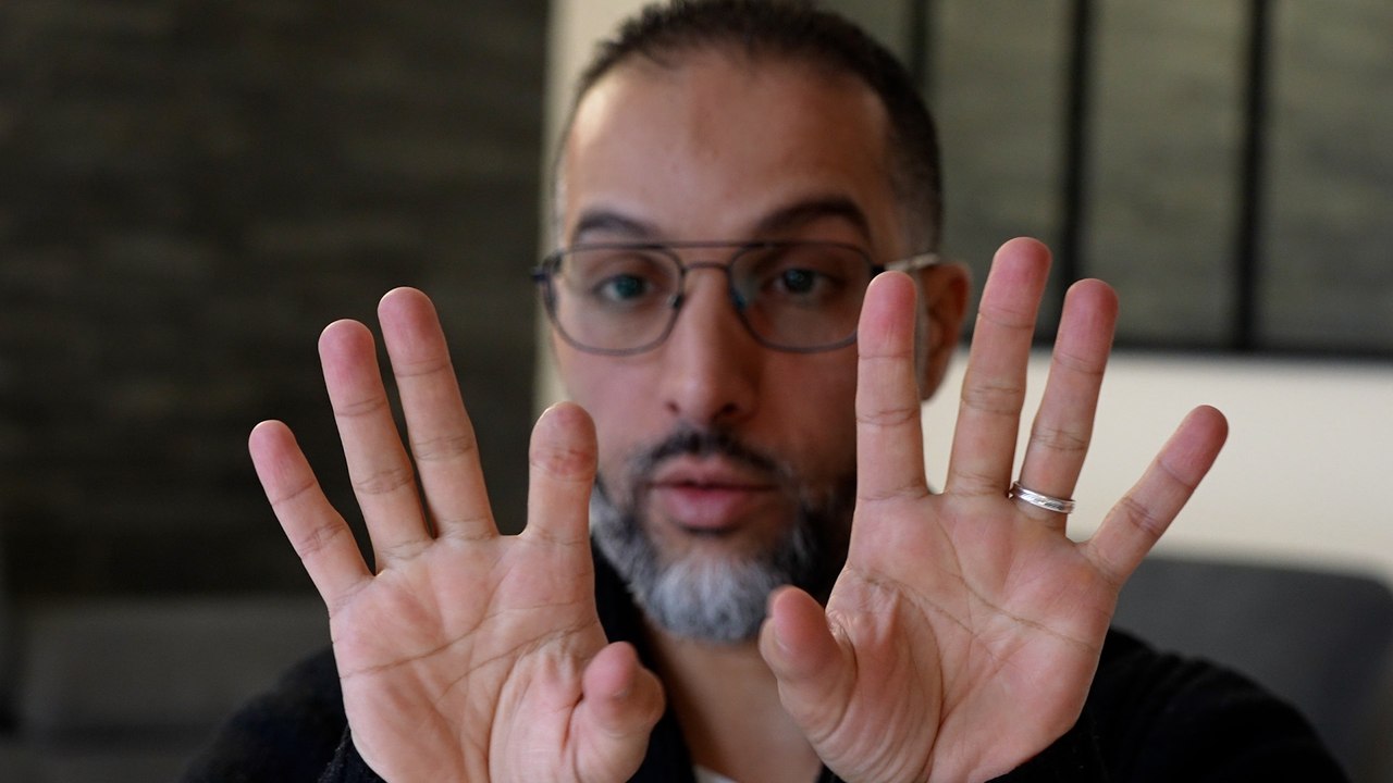 Abderrahmane veut déménager après avoir été mutilé par le chien de ses voisins