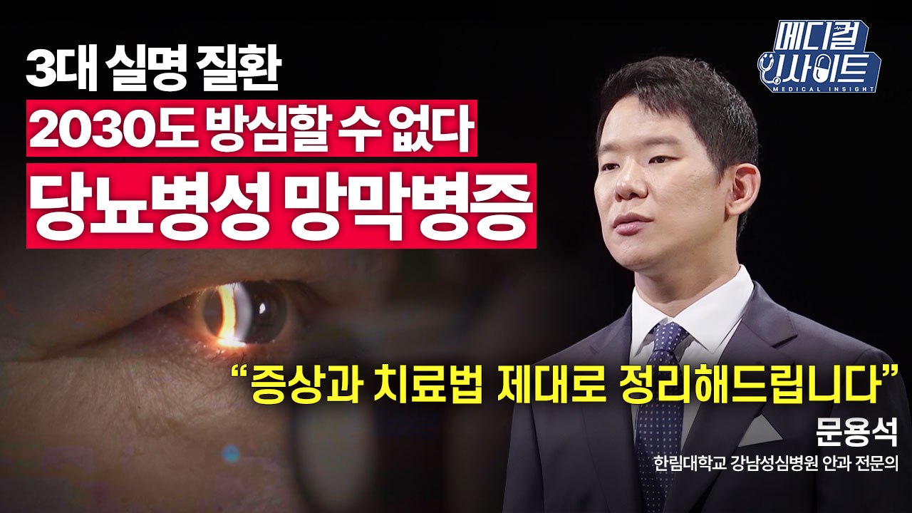 [메디컬 인사이트 62회] 안과 전문의가 알려주는 '당뇨병성 망막병증'의 증상과 치료...