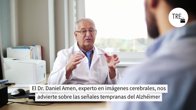 Este psiquiatra desvela cuáles son las cuatro señales y factores de riesgo de padecer Alzhéimer: en realidad comienza en el cerebro décadas antes de que tengas algún síntoma”