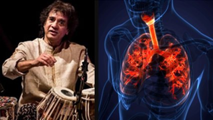 Tabla Maestro Zakir Hussain Passes Away: Pulmonary Fibrosis Kya Hai | Symptoms and Reason