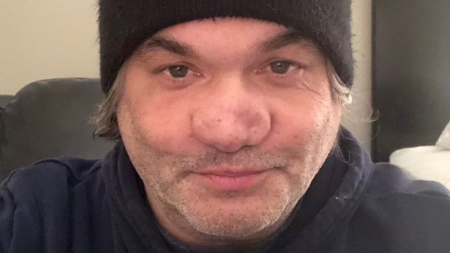 The Tragic Life Of Artie Lange