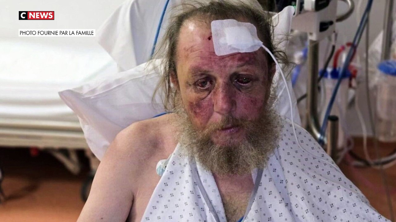 Antibes : Un menuisier de 55 ans tabassé gratuitement en pleine rue par 3 jeunes après avoir été bousculé - Il a le poumon perforé, 8 côtes cassées, épaule et mâchoire fracturées et son œil est sorti de son orbite...