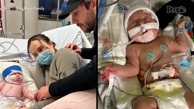 Baby Has $5 Million Surgery to Remove Left Side of Brain at Just 4 Weeks Old. Now He's Waiting for the Next One (Exclusive)