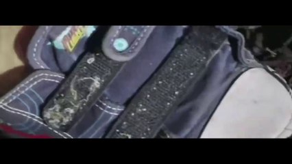 HULK FEET GROWTH COMP #1