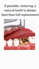 If you want to save natural tooth...