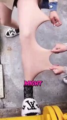 Stretchy Skin 😨