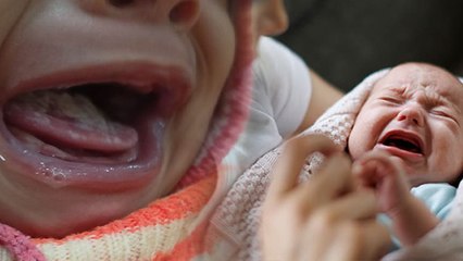 Lip Blisters In Baby: शिशुओं के होंठों पर छाले होने के कारण, Causes, Treatment..|