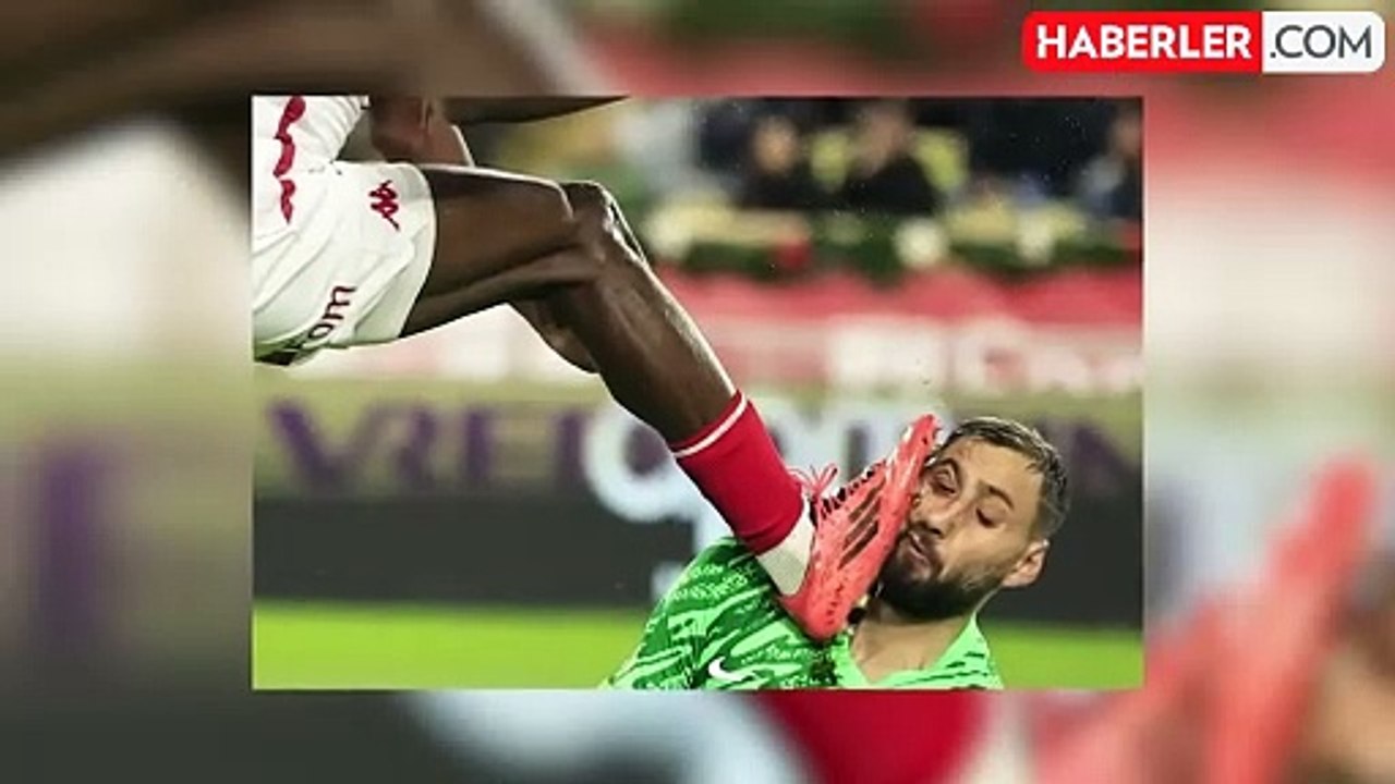 Yıldız kalecinin suratı paramparça oldu