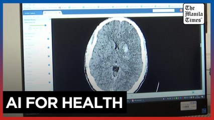 Revolutionary AI Software Doubles Stroke Diagnosis Accuracy 🧠