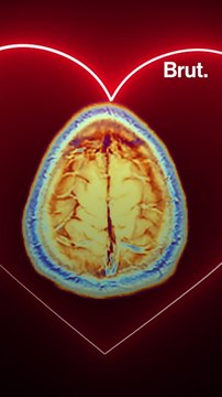 Que se passe-t-il dans le cerveau quand on tombe amoureux ?
