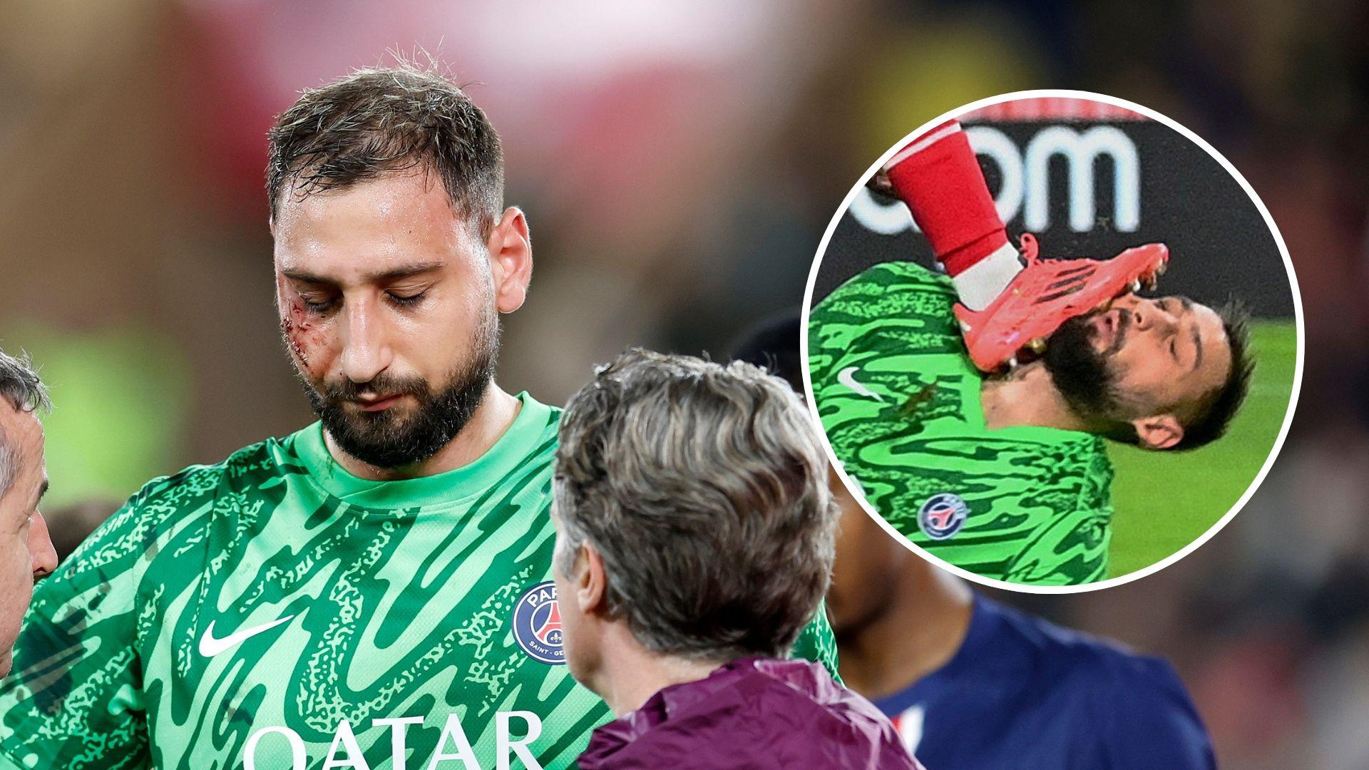Here's the hard hit Donnarumma took.mp4