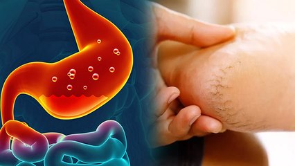 पेट खराब होने से एड़ियां फटती है क्या | Does Gut Health Cause Cracked Heels, FACT CHECK