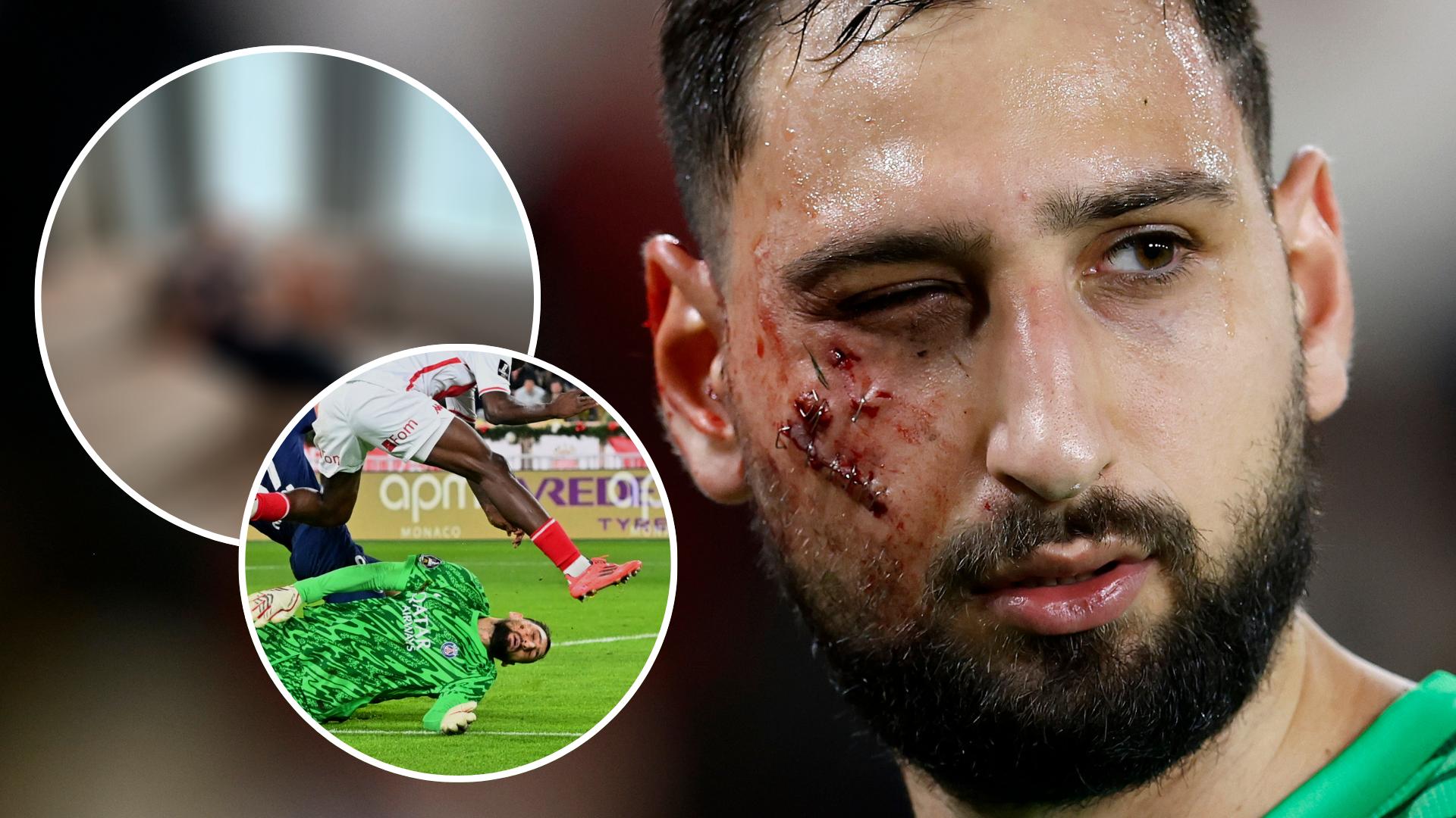 Here’s the hard hit Donnarumma took