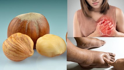 Hazel Nuts Benefits In Hindi: हेजलनट्स खाने के फायदे, Weight Loss To Heart Attack | Boldsky